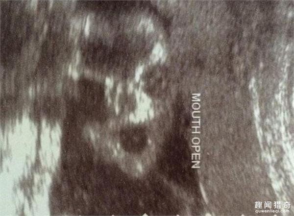 准妈妈去体检,看到b超下的婴儿差点吓哭!