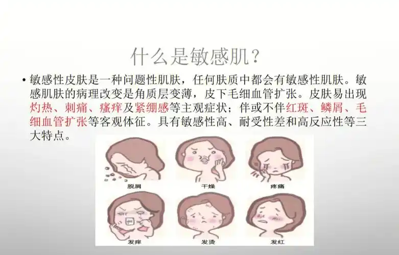 什么是敏感肌如何避免成为敏感肌