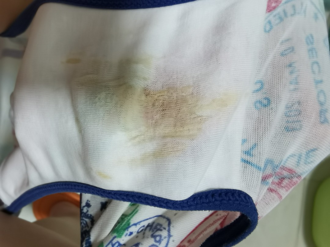 有没有宝妈13周77白带颜色偏黄,偶尔流出黄色的奶状 | 妈妈网轻聊