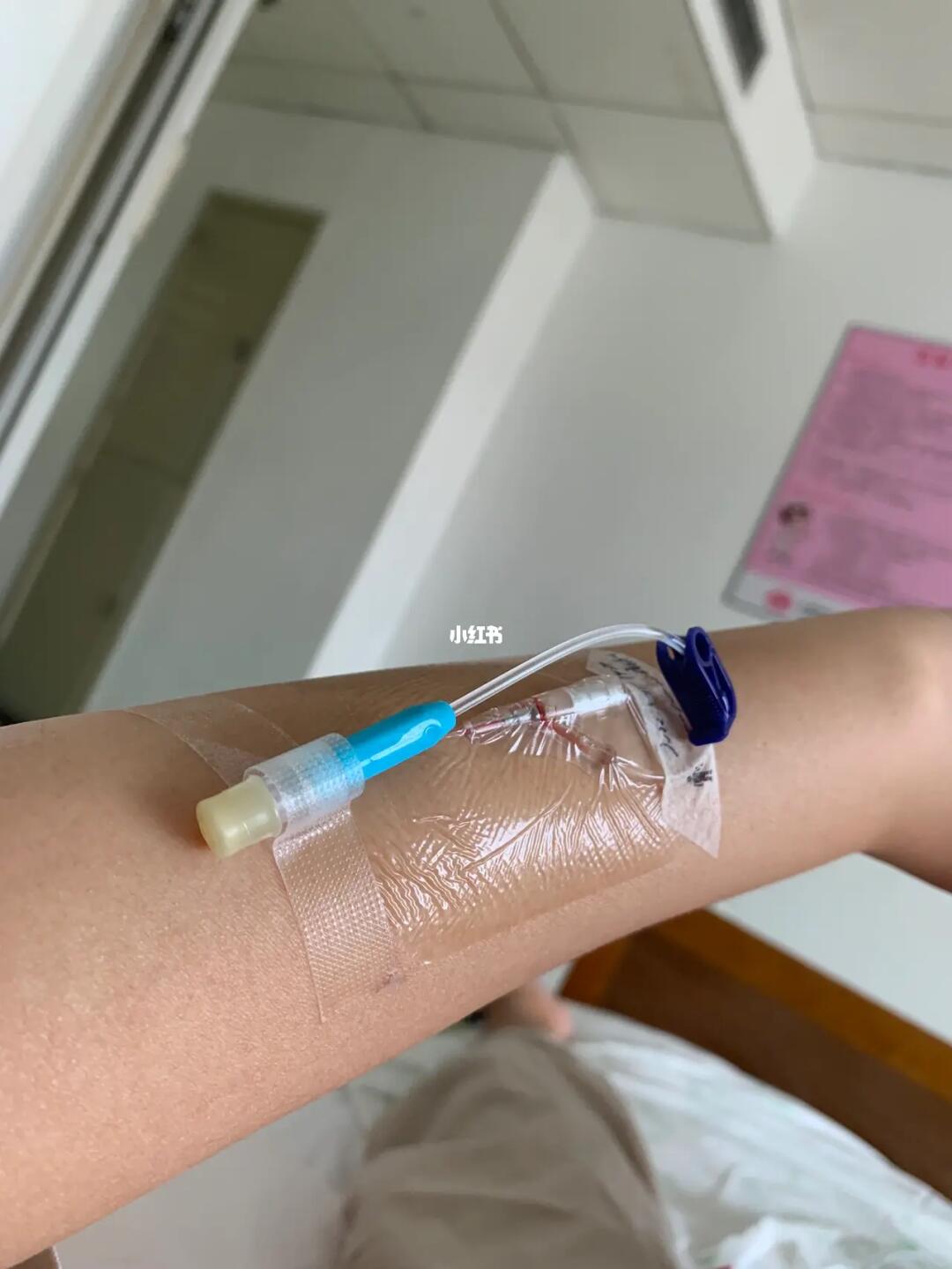 右手带手环左手扎针医院待产