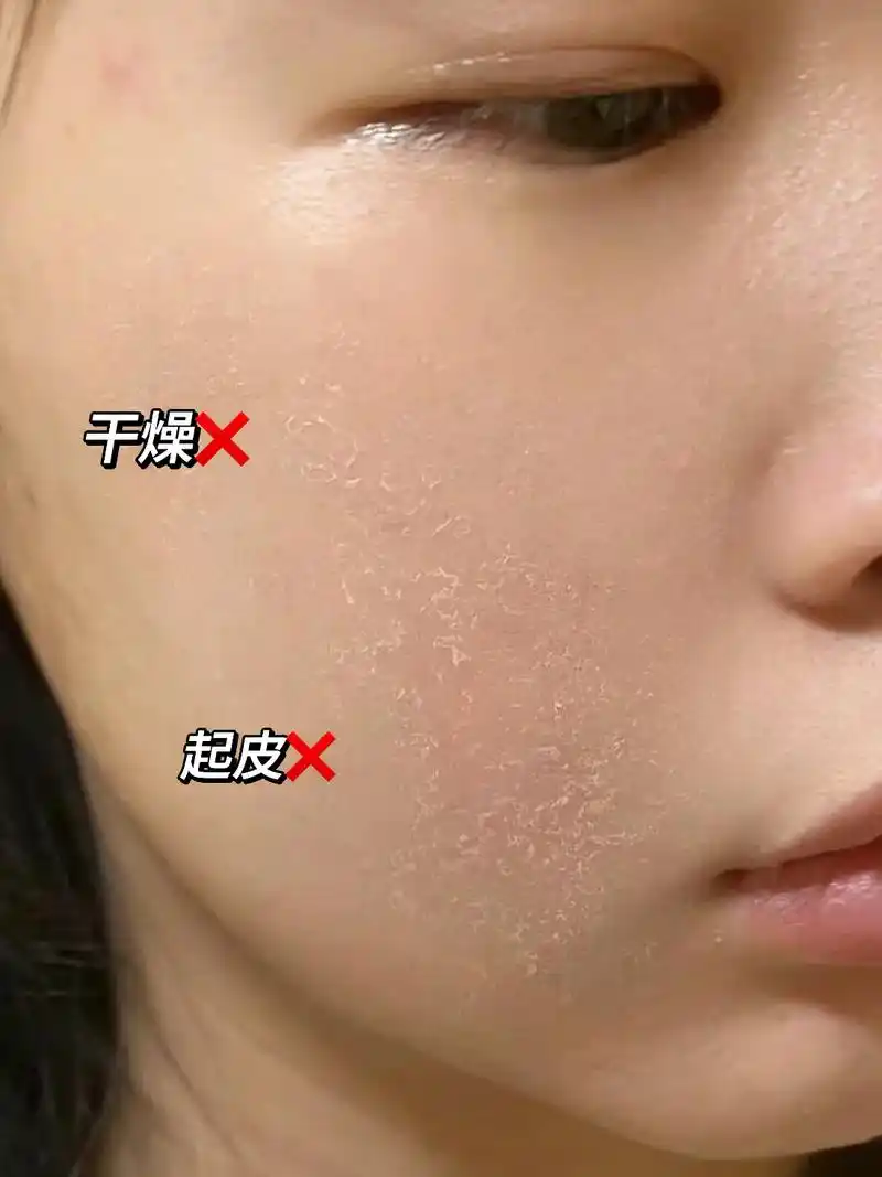 皮肤干燥又粗糙!显得老!还在为冬季皮肤状态差烦 - 抖音