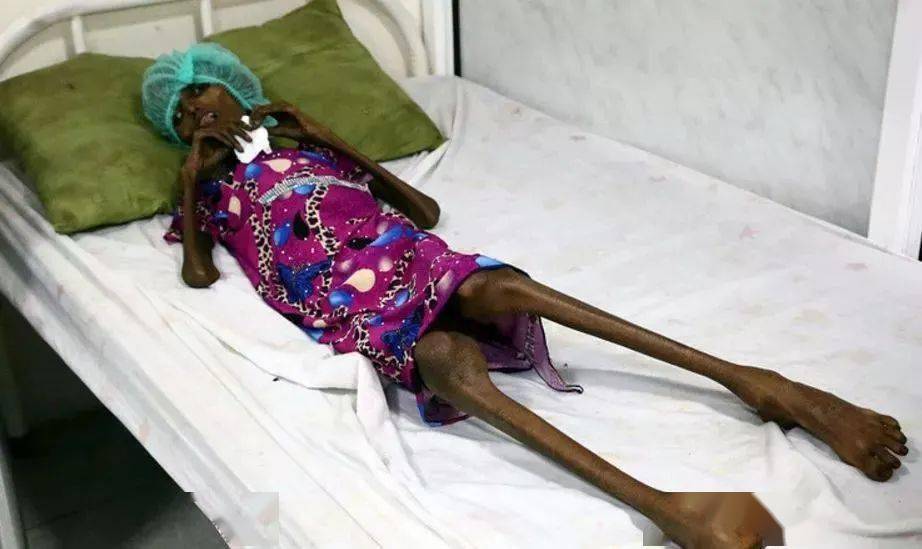 如果没有恰特草,如果没有战争,就没有瘦得皮包骨的饥饿女孩,也没有