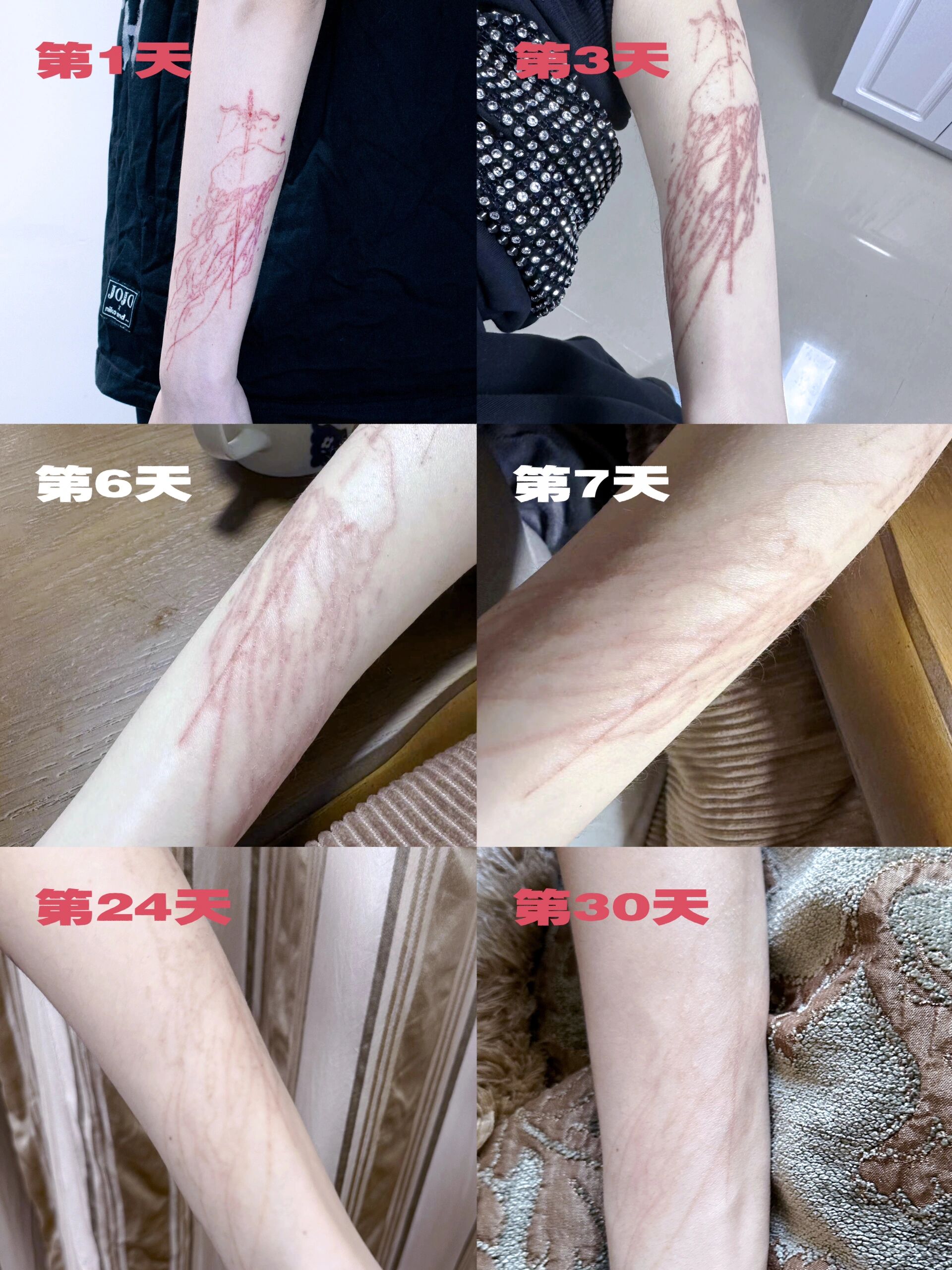 空针纹身恢复过程 非常适合空针纹身的元素水母08 来看看他在身体里