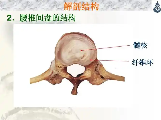 解剖结构 2,腰椎间盘的结构 髓核 纤维环