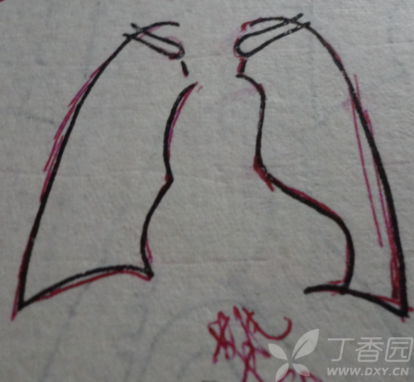 【求助】普大型心,梨形心,靴形心的片子究竟怎么看啊