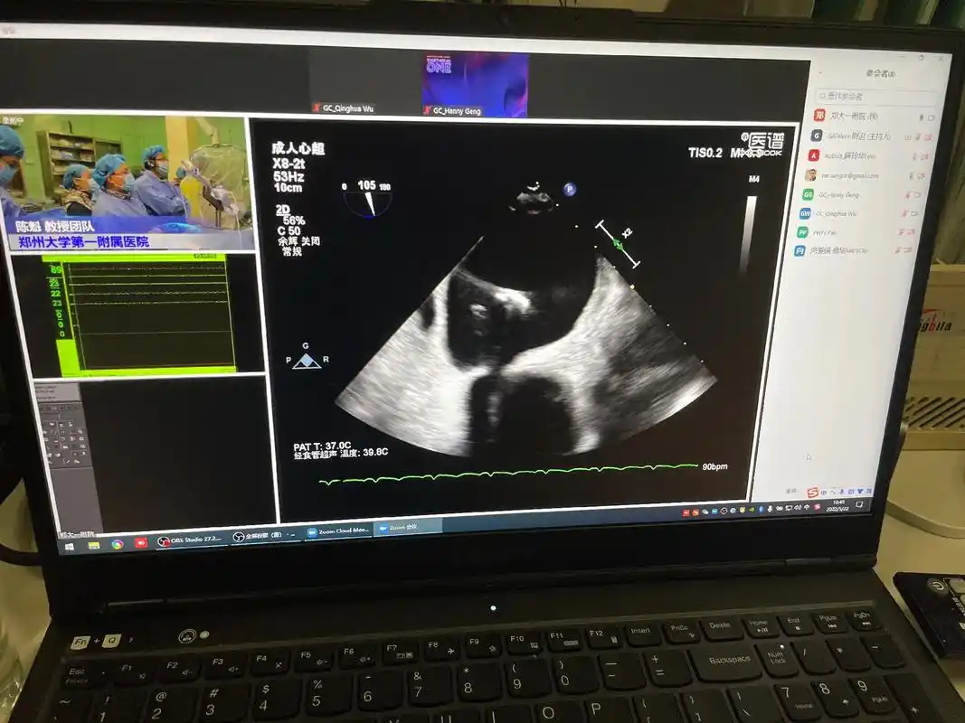 二尖瓣关闭不全患者的福音,不开刀修复二尖瓣!