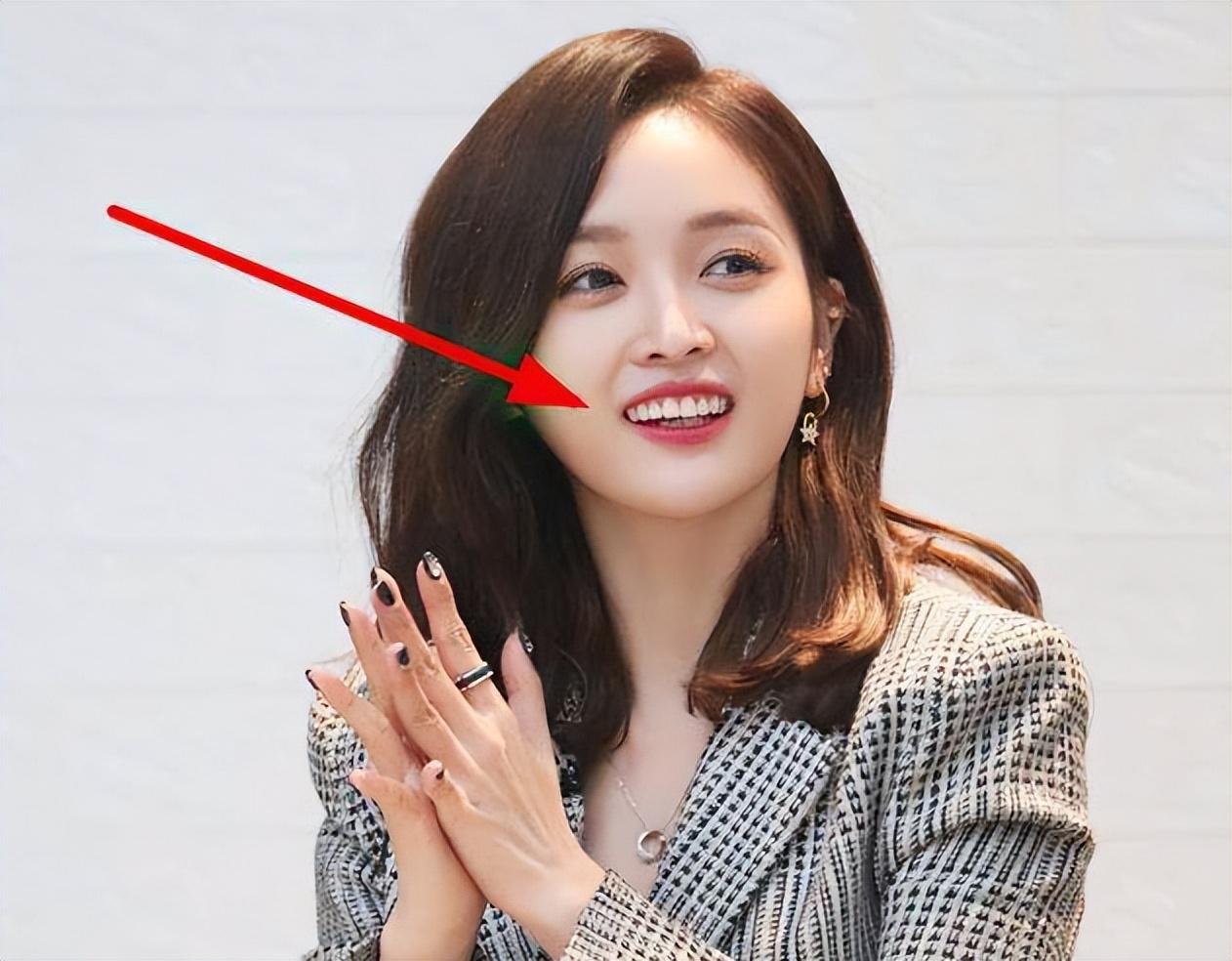 女明星"假牙"大pk,谁的嘴巴闭不上,谁的嘴里藏着一套房?