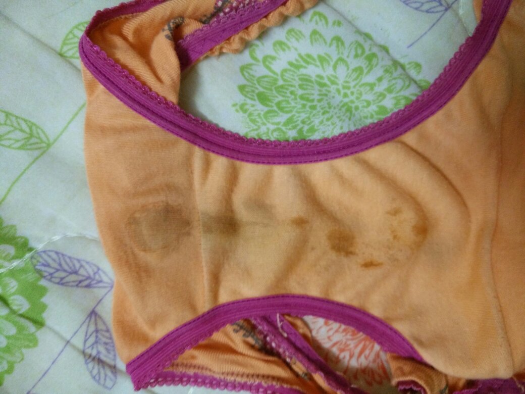 怀孕快两个月了,这两天内裤有黄色的,刚才看到内裤这些是什么,是不是