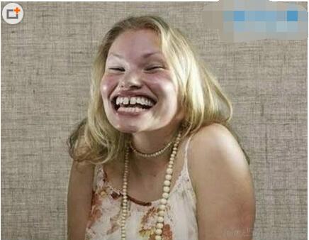 真实的丑女图片欣赏,能看完算我输(世界上最丑的女人揭晓)