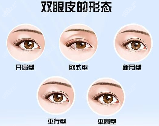 兰州时光的罗梅医生做全切双眼皮的形状