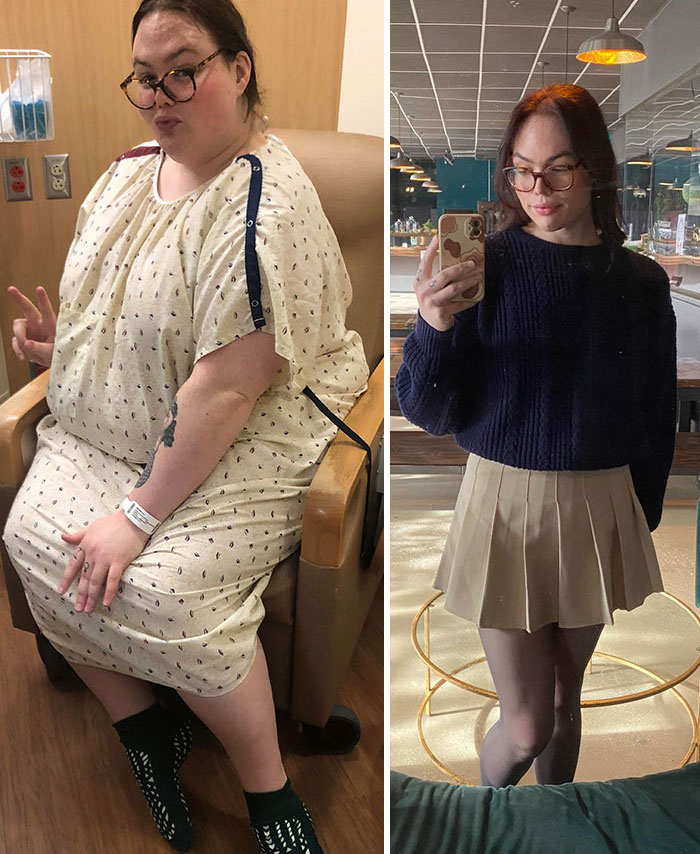 体重图片真实(20张减肥前后对比照) - 赤虎壹号