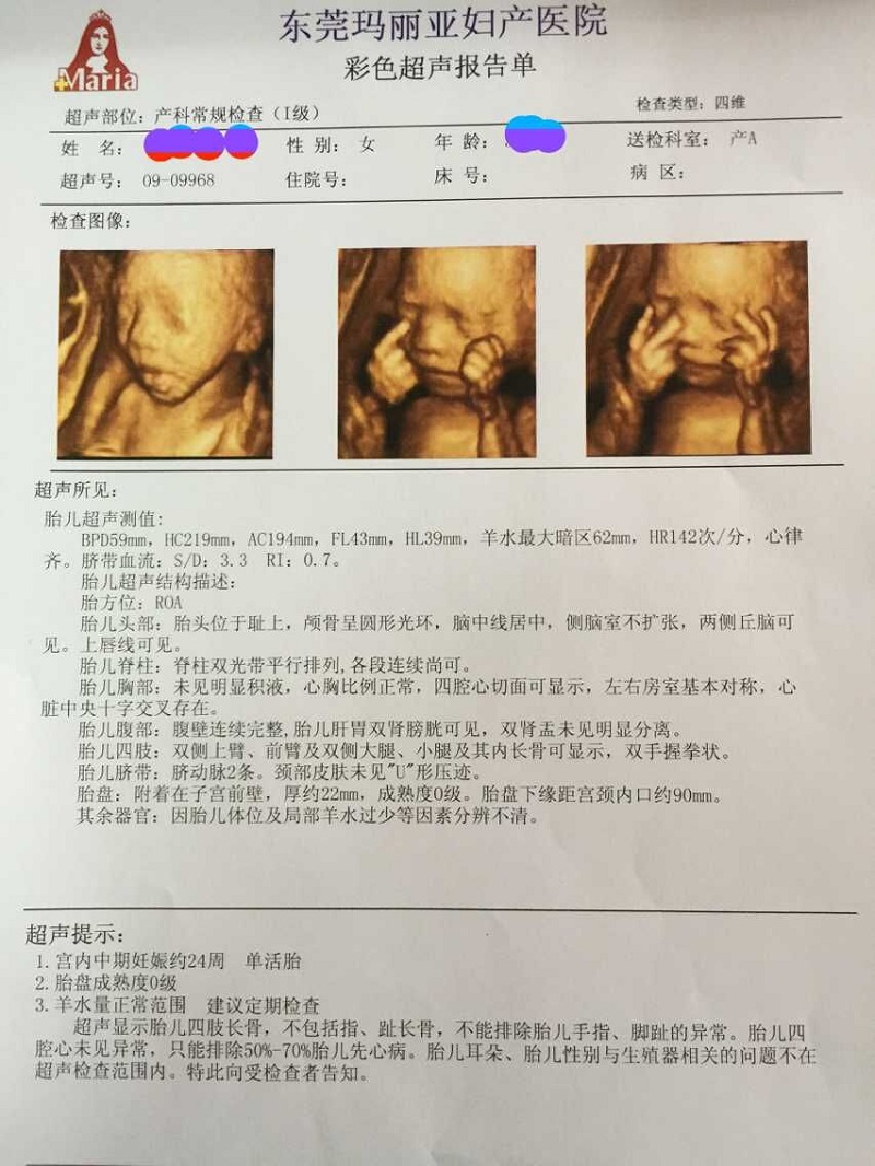 四维彩超哪3个亮点能辨别出是怀的男孩