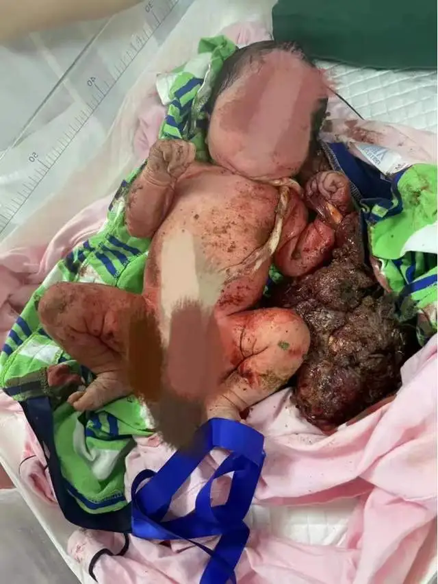 广州天河新生婴儿被遗弃全城用爱心托起生命方舟