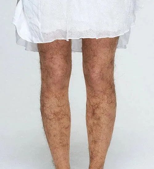 女生腿毛"又长又黑"是怎样的体验?为什么有的女生腿毛很浓密?