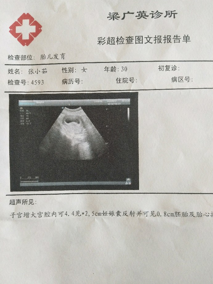 45天孕囊和3个月的彩超 帮忙看看男孩女孩
