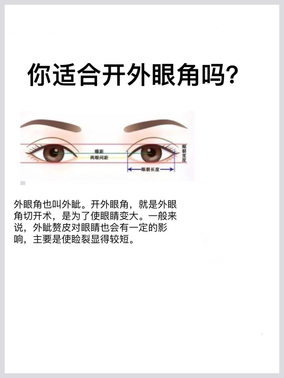 你适合开外眼角吗