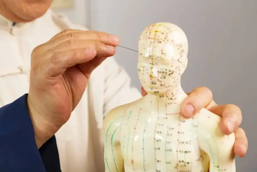 【医文医话】针灸一科:"扎脸"治全身?——颊针疗法膝痛篇