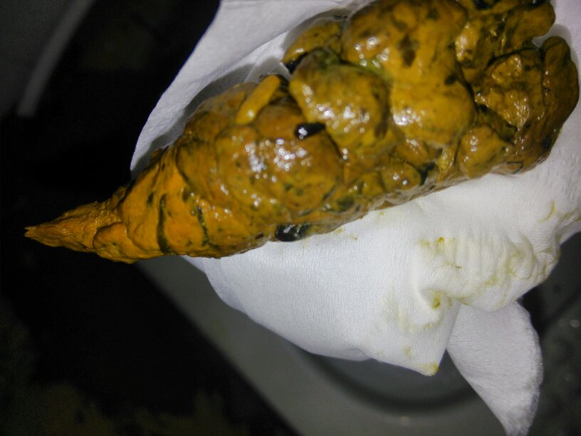 这样大便正常吗