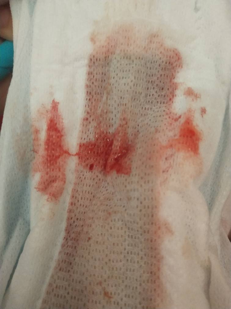 你们来月经有黏黏的东西吗