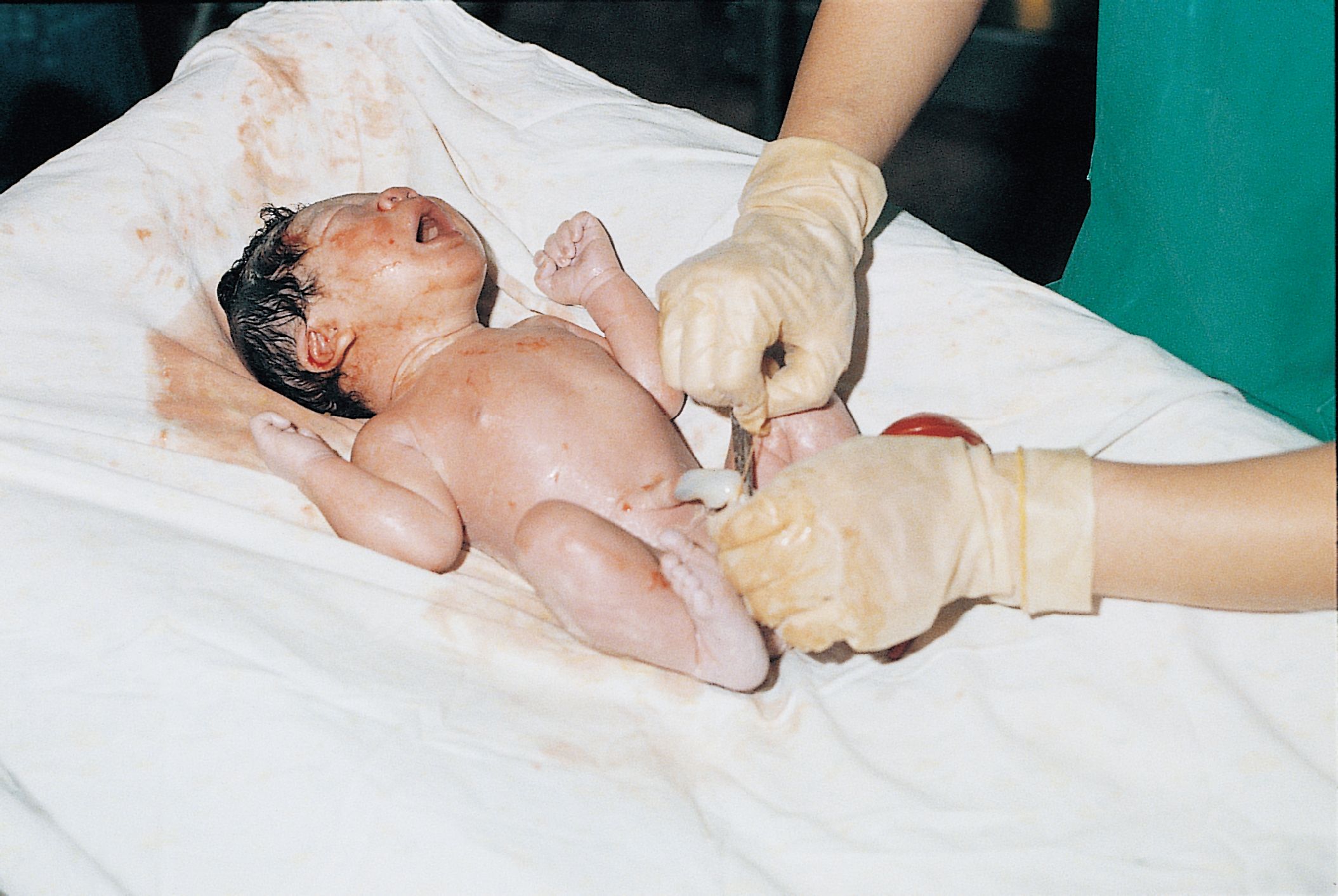 图解自然分娩全过程,胆小者勿入!