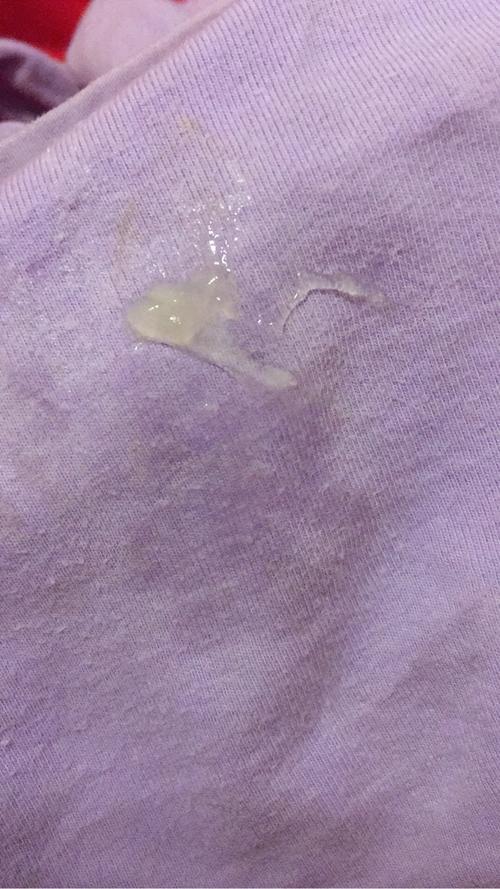 下面流出白色透明的粘液体是什么