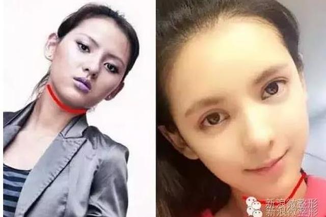 张予曦离开王思聪,靠一张混血脸从网红升级成了网剧女主