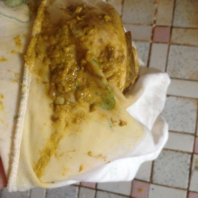 我宝经常拉这种烂屎怎麼回事