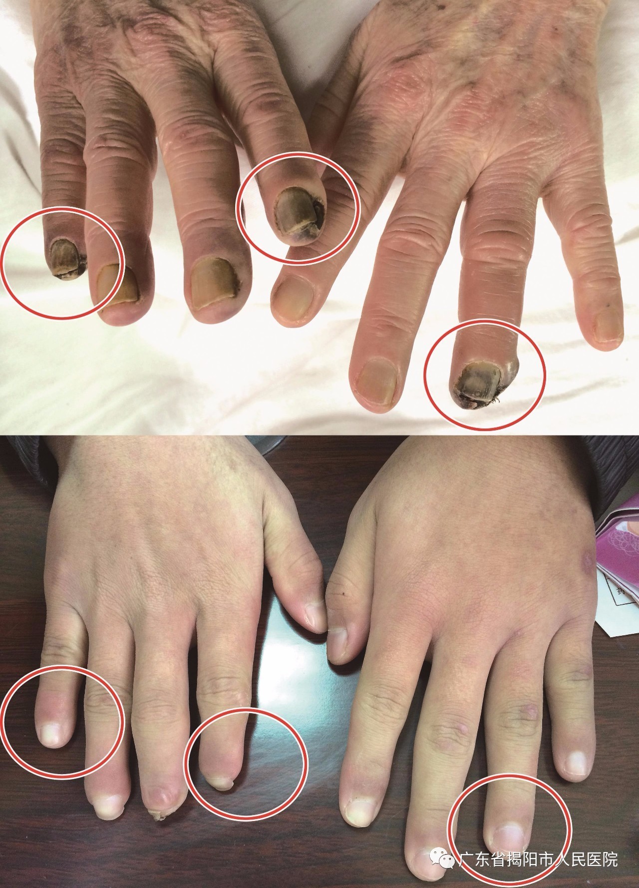 走进市人民医院风湿免疫科:诊疗技术不断攀上新高峰