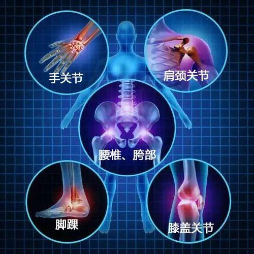 缓解全身各部位关节酸麻,僵硬和肿痛!