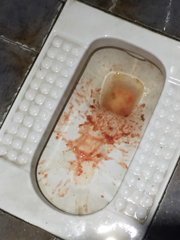 今天喝酒,3瓶多,然后吐了,有红色是吐血吗