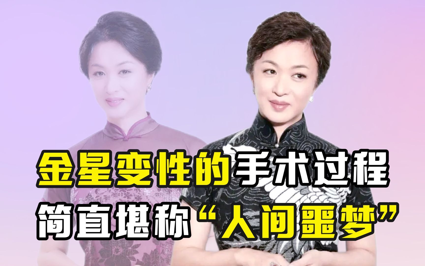 金星变性的手术过程,简直堪称"人间噩梦"