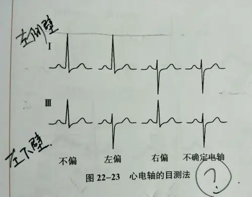 每个人都可以了解点 心电学知识,笑笑和你一起学 - it610.com