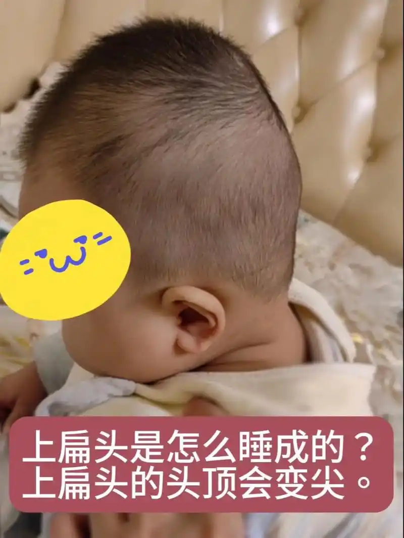宝宝平躺睡,要注意头部和身体的水平哦.如果宝宝平躺睡,头部和 - 抖音