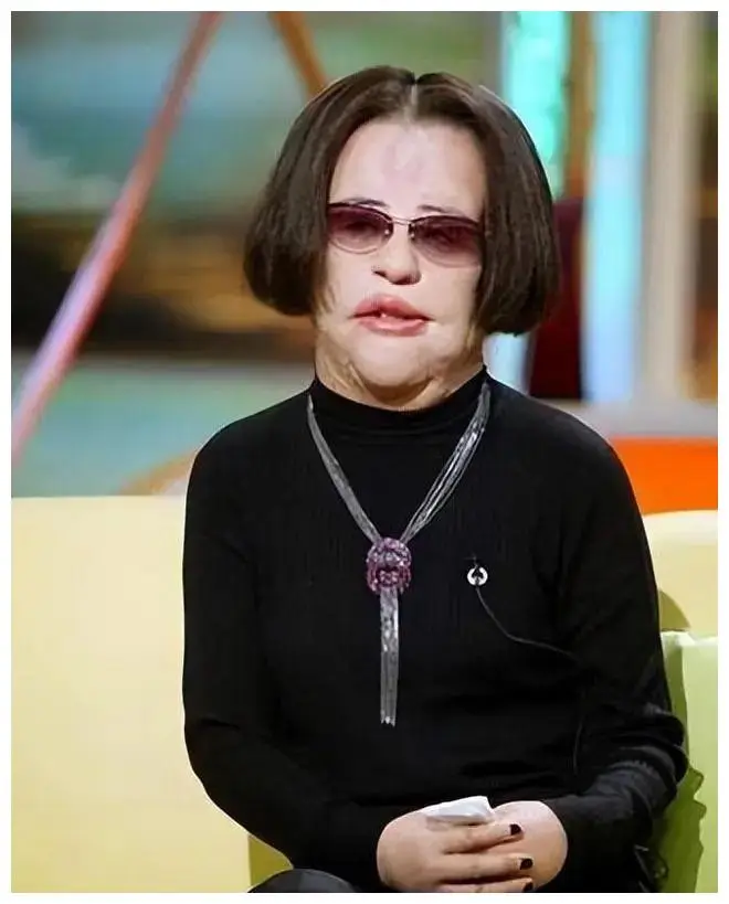 盘点娱乐圈被整容毁掉的美女明星,看看谁最让人同情?
