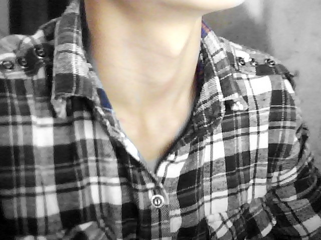 我今年15左右了,喉结一大个,但是不疼,不痒,我只是有点奇怪.