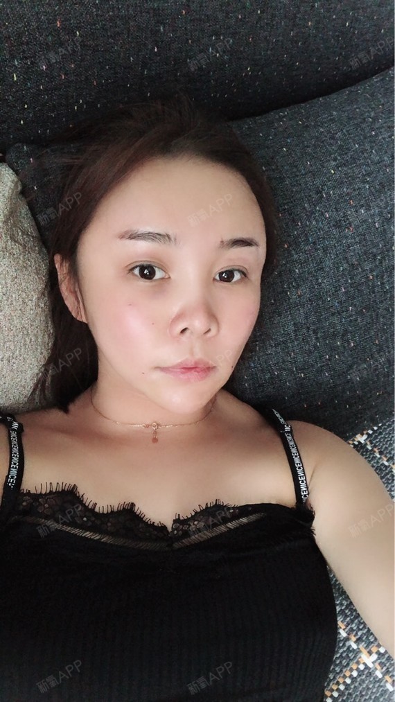 自体脂肪填充全脸