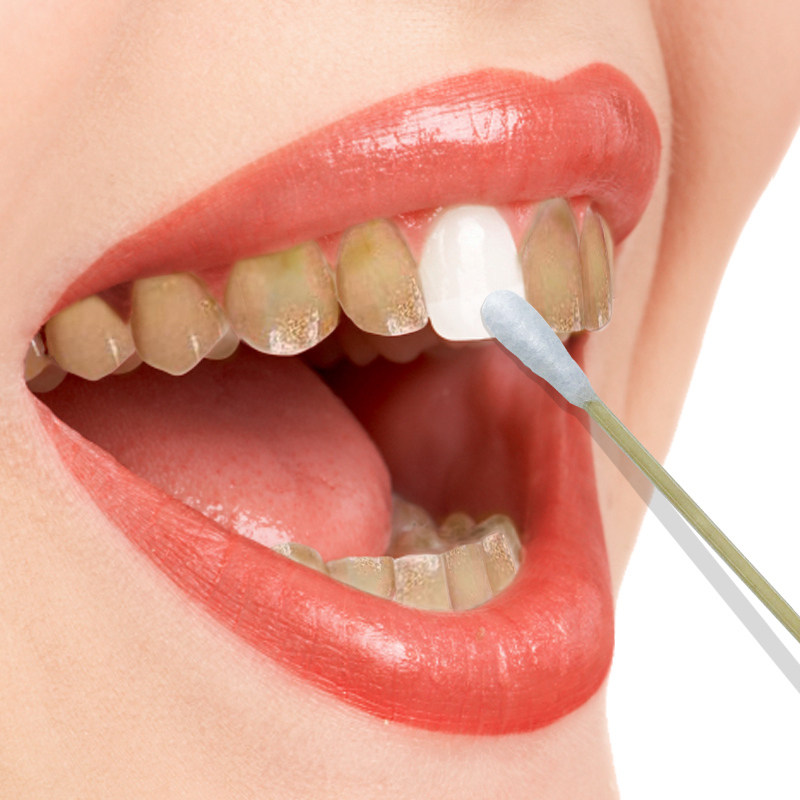 牙齿美白洗牙粉黄牙烟牙去牙垢牙斑烟渍牙结石洁牙素白牙素菌口臭_7折