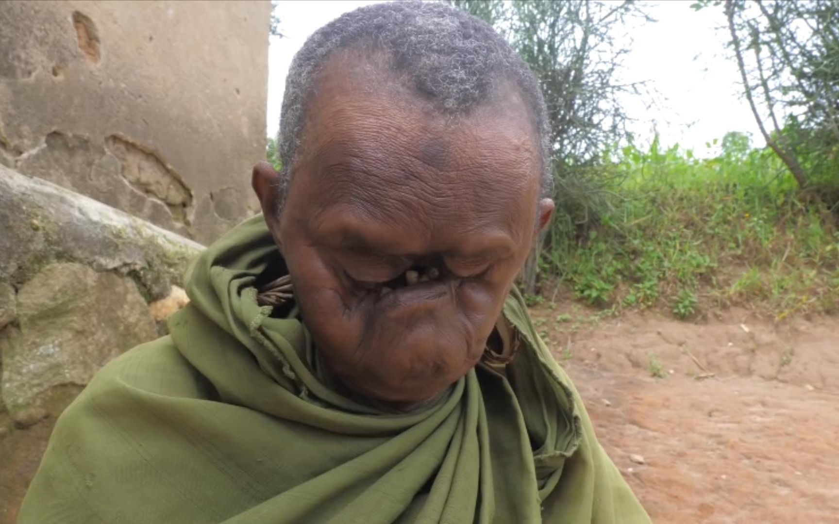 这不是特效非洲这位老奶奶面目全非她表示生来就这般模样