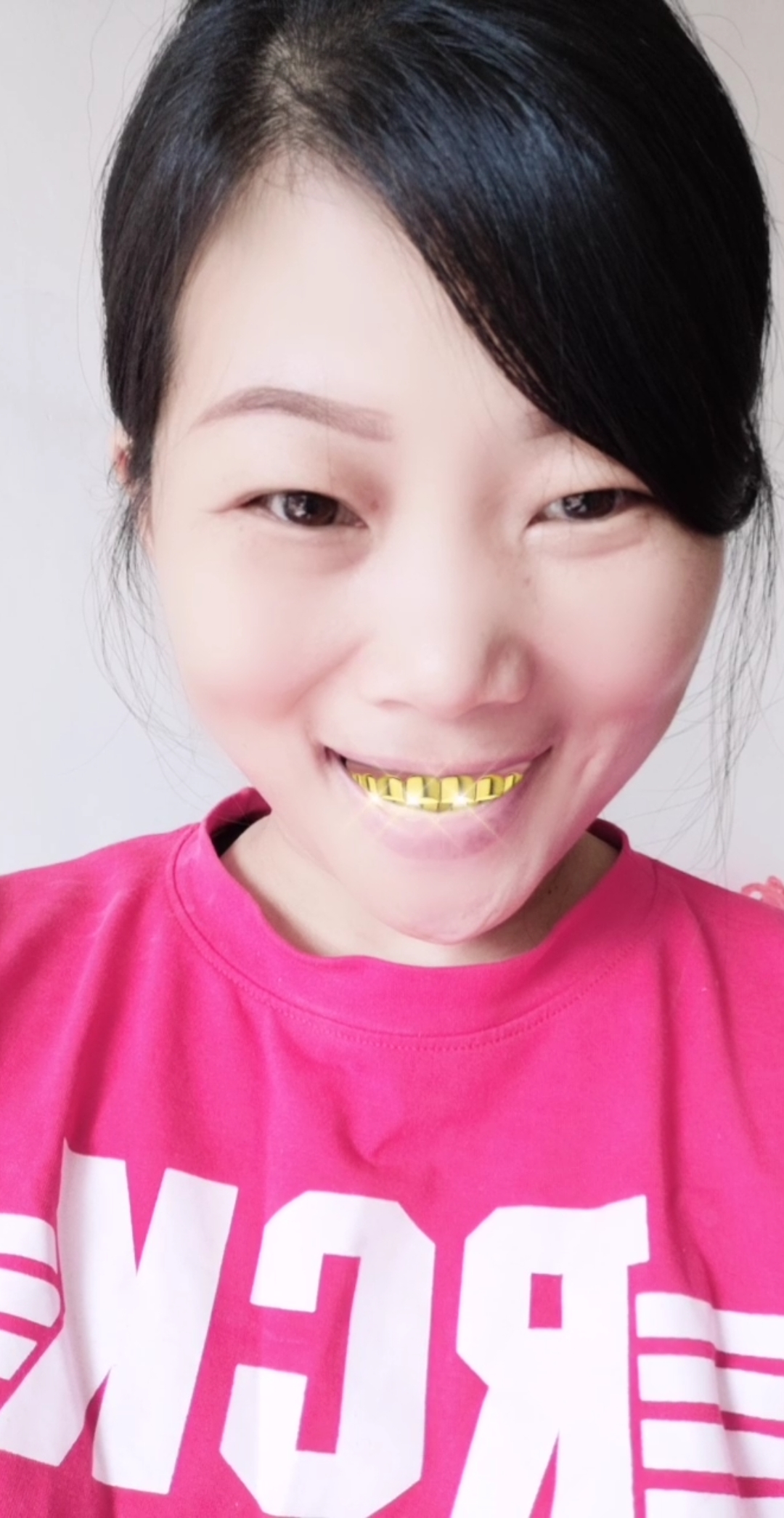 我刚镶了一口大金牙笑起来好看吧