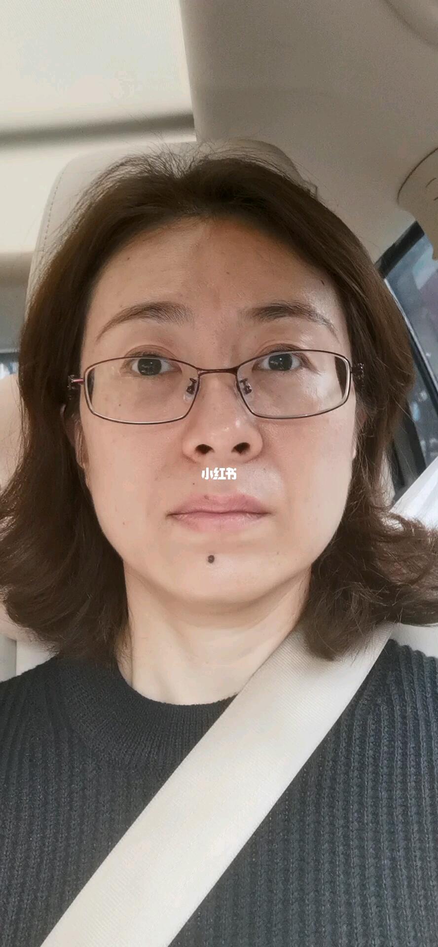 43岁,全素颜,有斑,有动态纹_素颜_人脸识别_化妆_保险_美妆_护肤_护肤