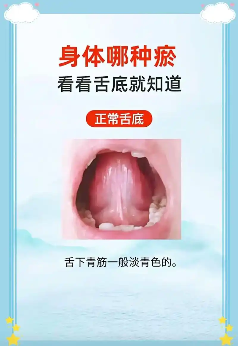 舌底看瘀#中医养生 #养生 #舌诊 - 抖音