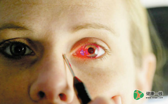 孔源性视网膜脱落诊断依据是?如何寻找视网膜裂孔?