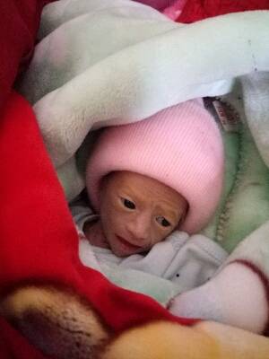 问答 婴儿期0-1岁 宝宝树孕育 90%的妈妈正在使用 宝宝树孕育 90%的