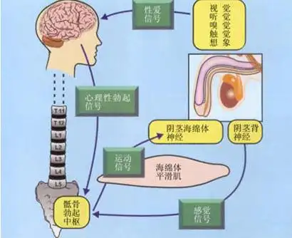 勃起功能障碍术的图解