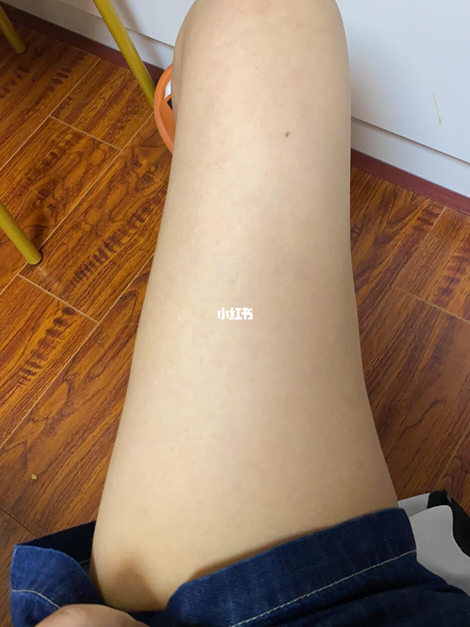 减肥是成功了但是这大腿根我真的受不了