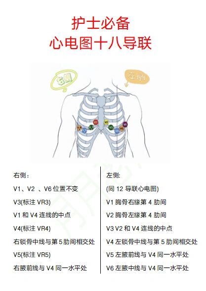 护士必备心电图十八导联
