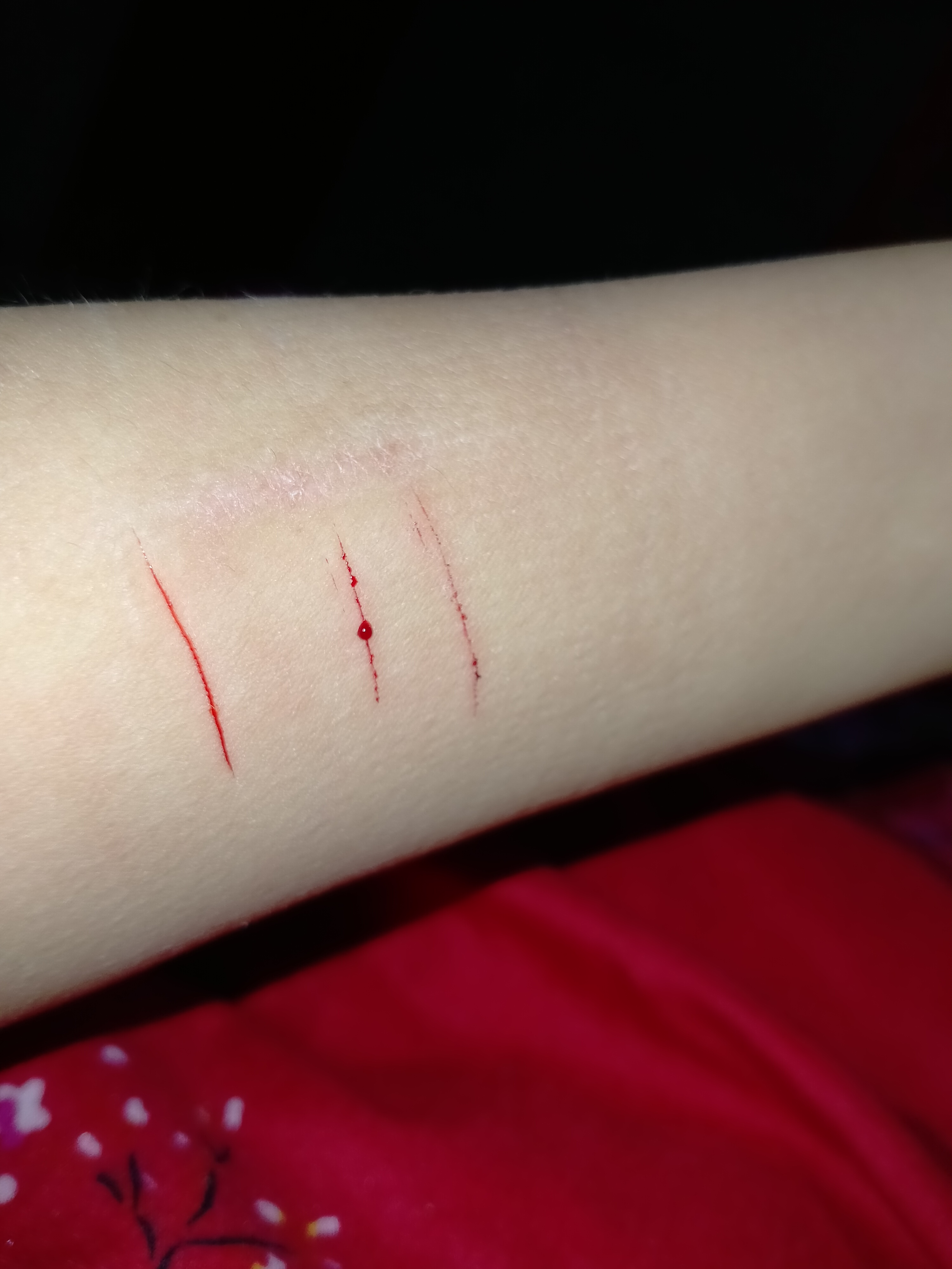 2021-01-04 05:50:39 倾听者感情咨询 0 来啊快活啊自残啊