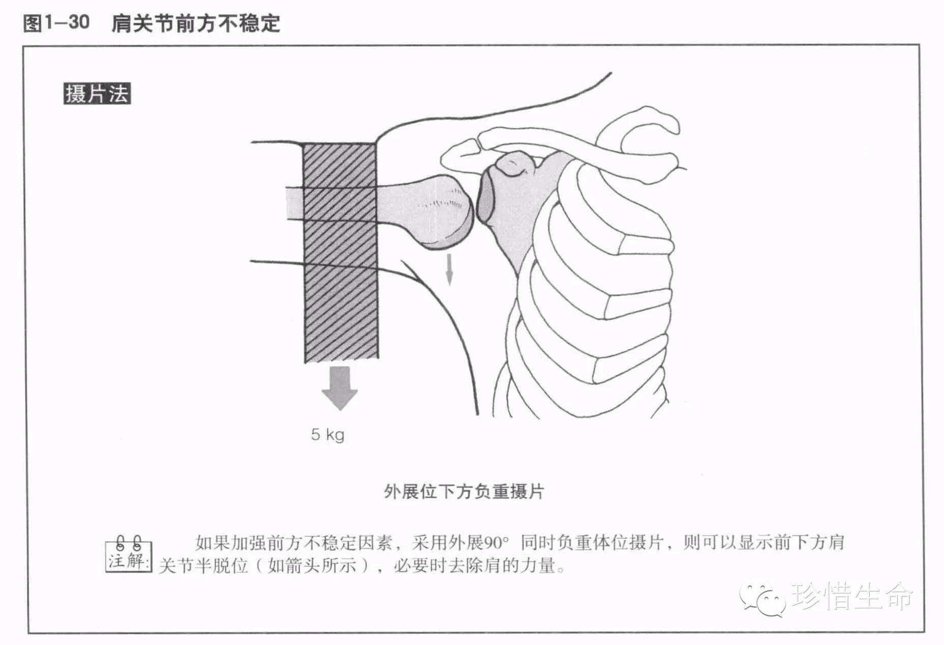 肩关节x线检查体位大全