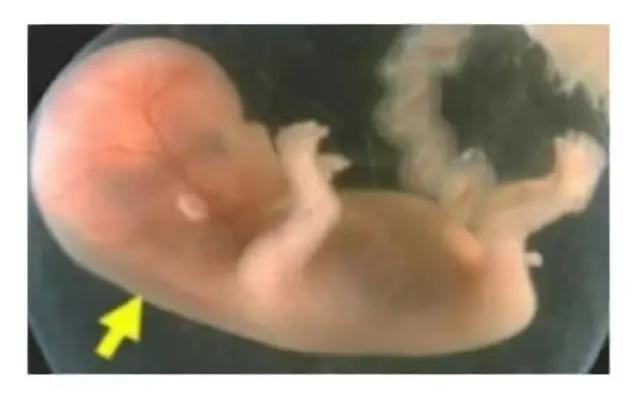 需要空腹憋尿吗?和普通b超有什么关系?怎么做能顺利通过?