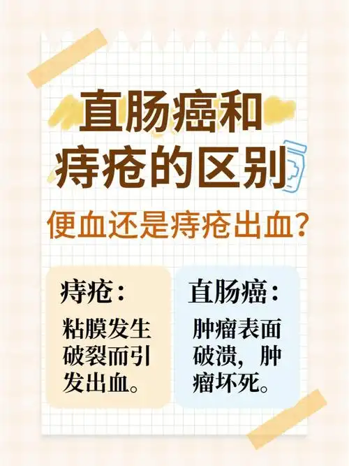 直肠癌和痔疮的区别|便血还是痔疮出血?